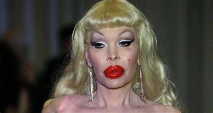 Amanda Lepore has ‘the most expensive body in the world’ – this is her net worth