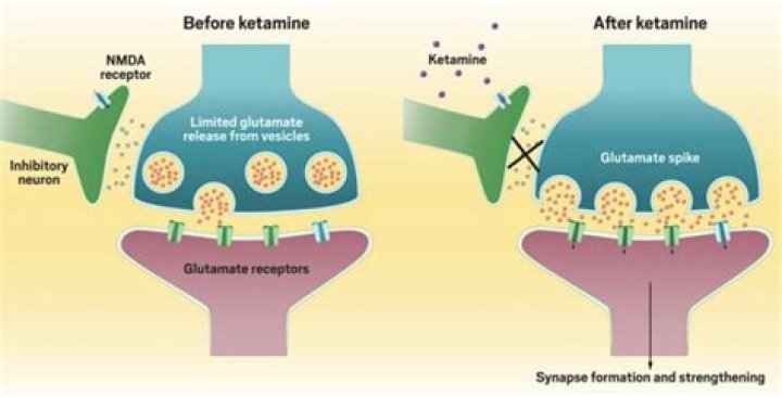 Caution urged over use of fast-acting version of ketamine for depression