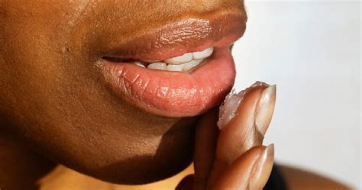 How to get rid of chapped lips, according to dermatologists