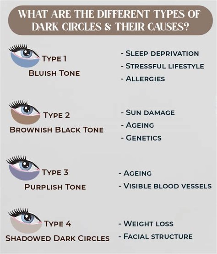 How To Get Rid Of Dark Circles And Eye Bags ASAP, According To Skin Experts